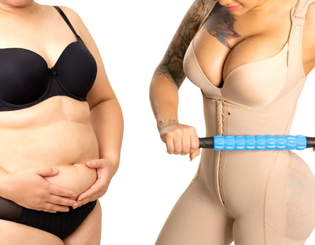 Why you need to use a roller pin after liposuction